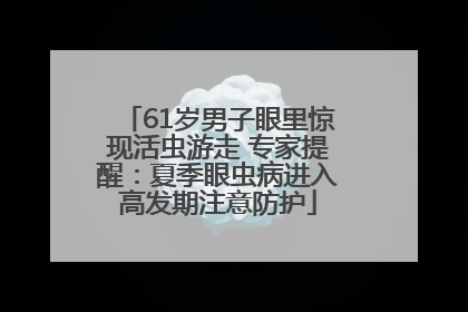 61岁男子眼里惊现活虫游走 专家提醒：夏季眼虫病进入高发期注意防护